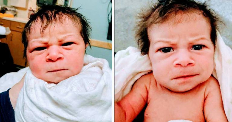 Baby born with an “angry” face and get Oligohydramnios diagnosis
