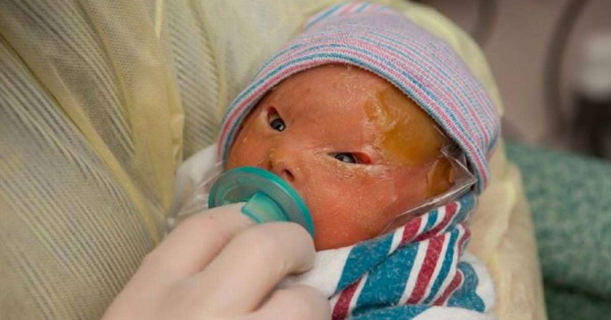 Mom is shocked when she sees her newborn in the delivery room – now her words are spreading like wildfire