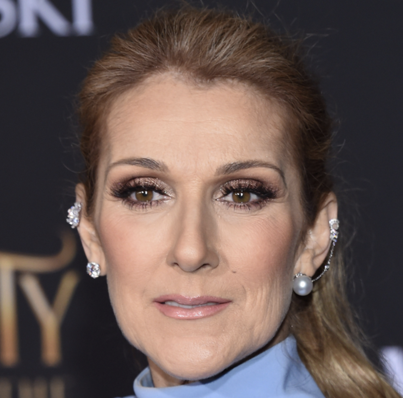 Celine Dion’s Battle with Stiff Person Syndrome Takes a Devastating Toll