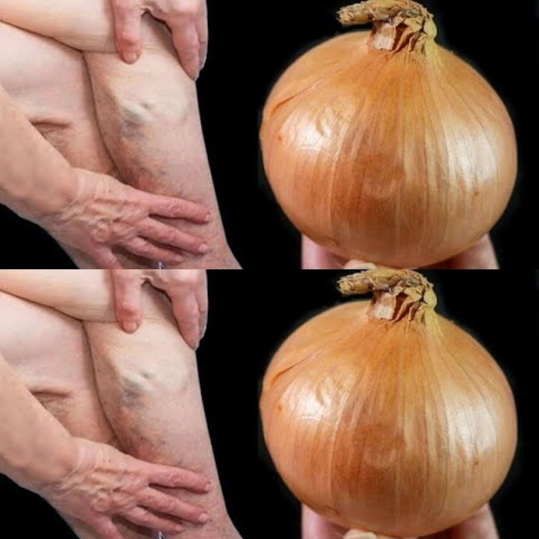 Mom’s Onion Remedies: Natural Healing for Everyday Aches and Pains