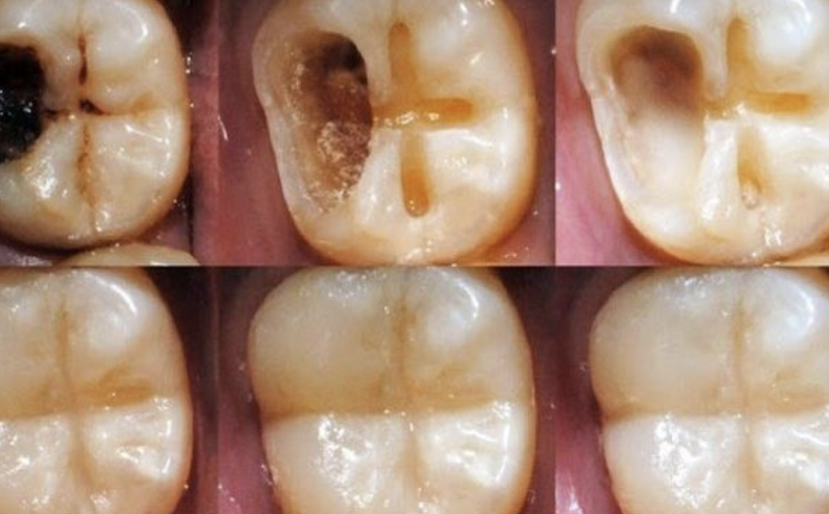 Natural Ways to Maintain Good Dental Health