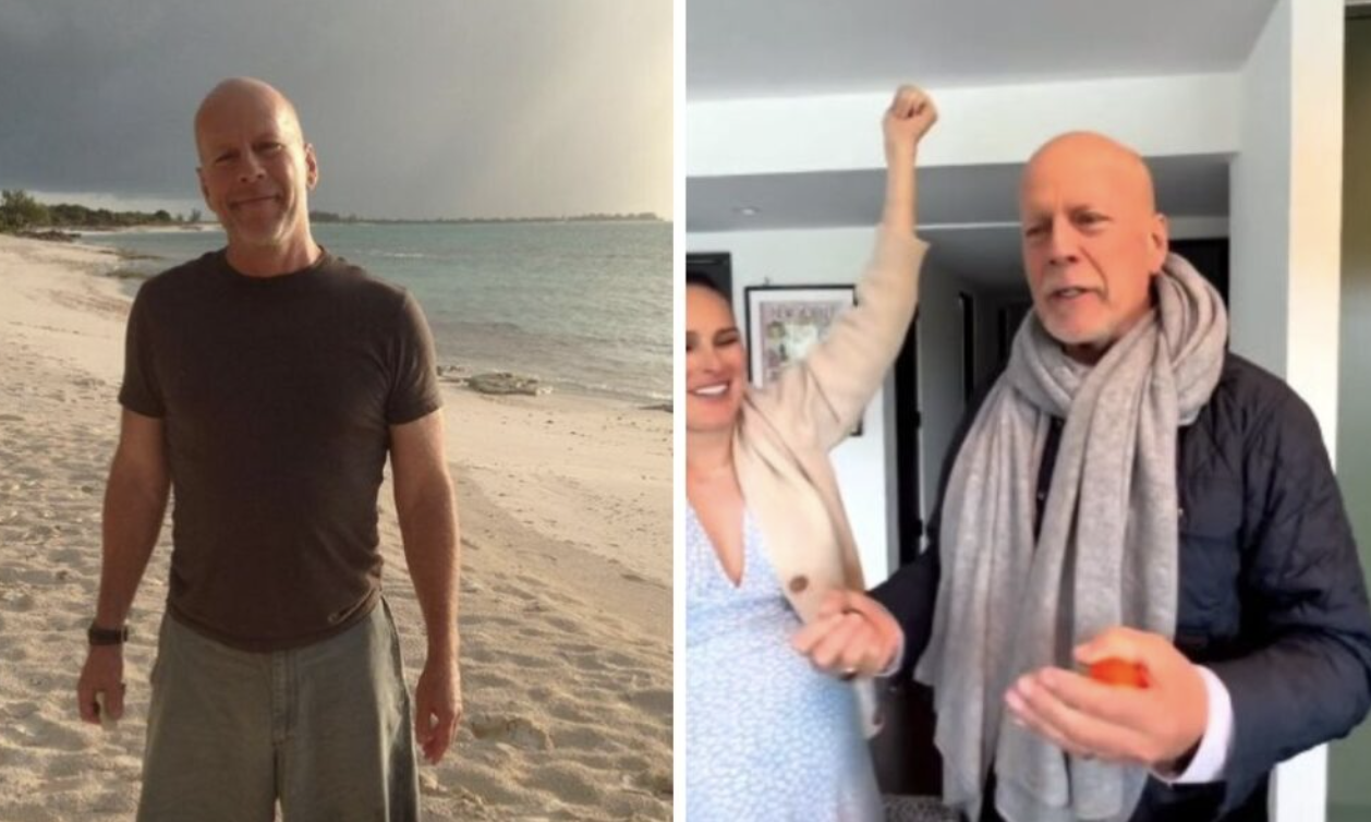 Bruce Willis’ Battle with Frontotemporal Dementia: A Heartfelt Update