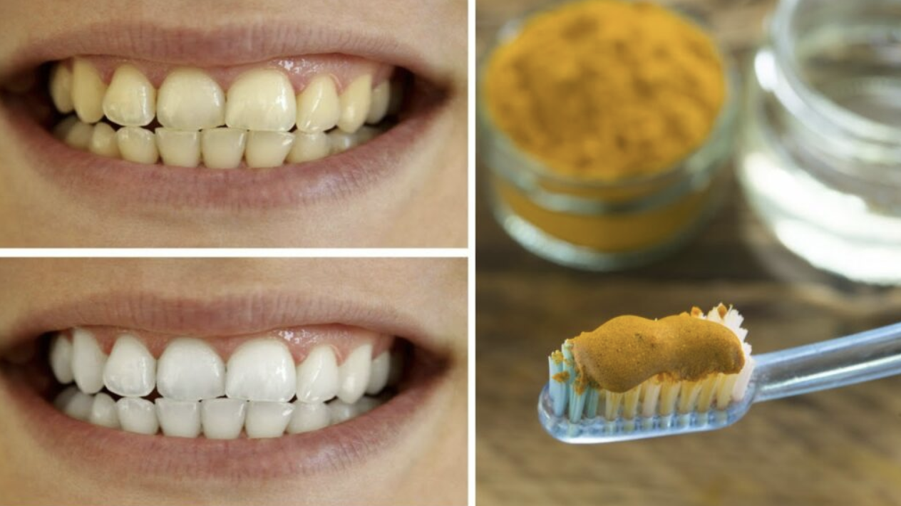 A Natural Solution for Brighter, Healthier Teeth