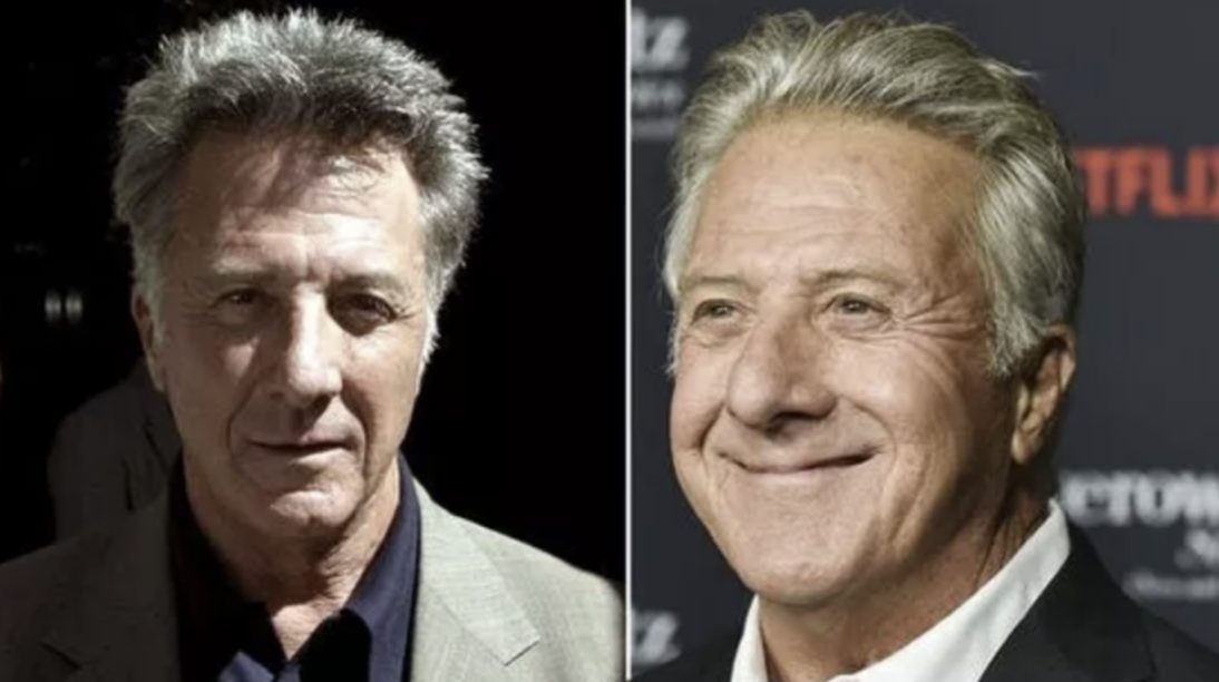 Dustin Hoffman Battles and Triumphs Over Cancer