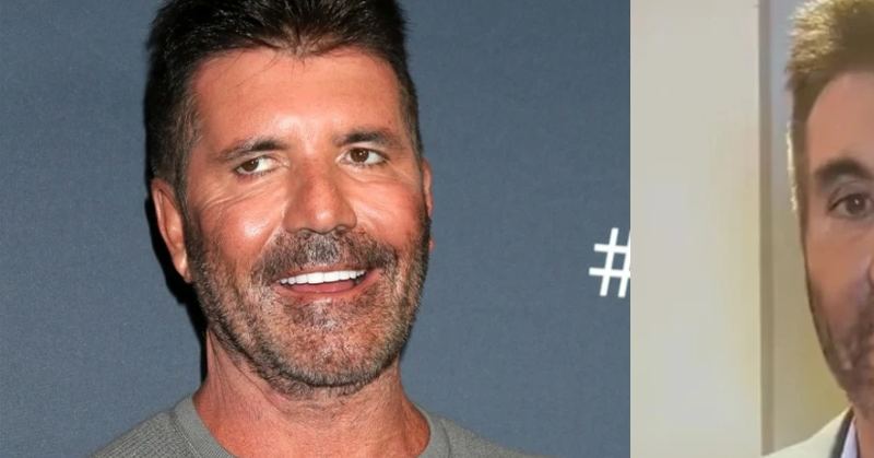 Simon Cowell: Fans Express Concerns Over His New Look